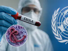 ebola virus